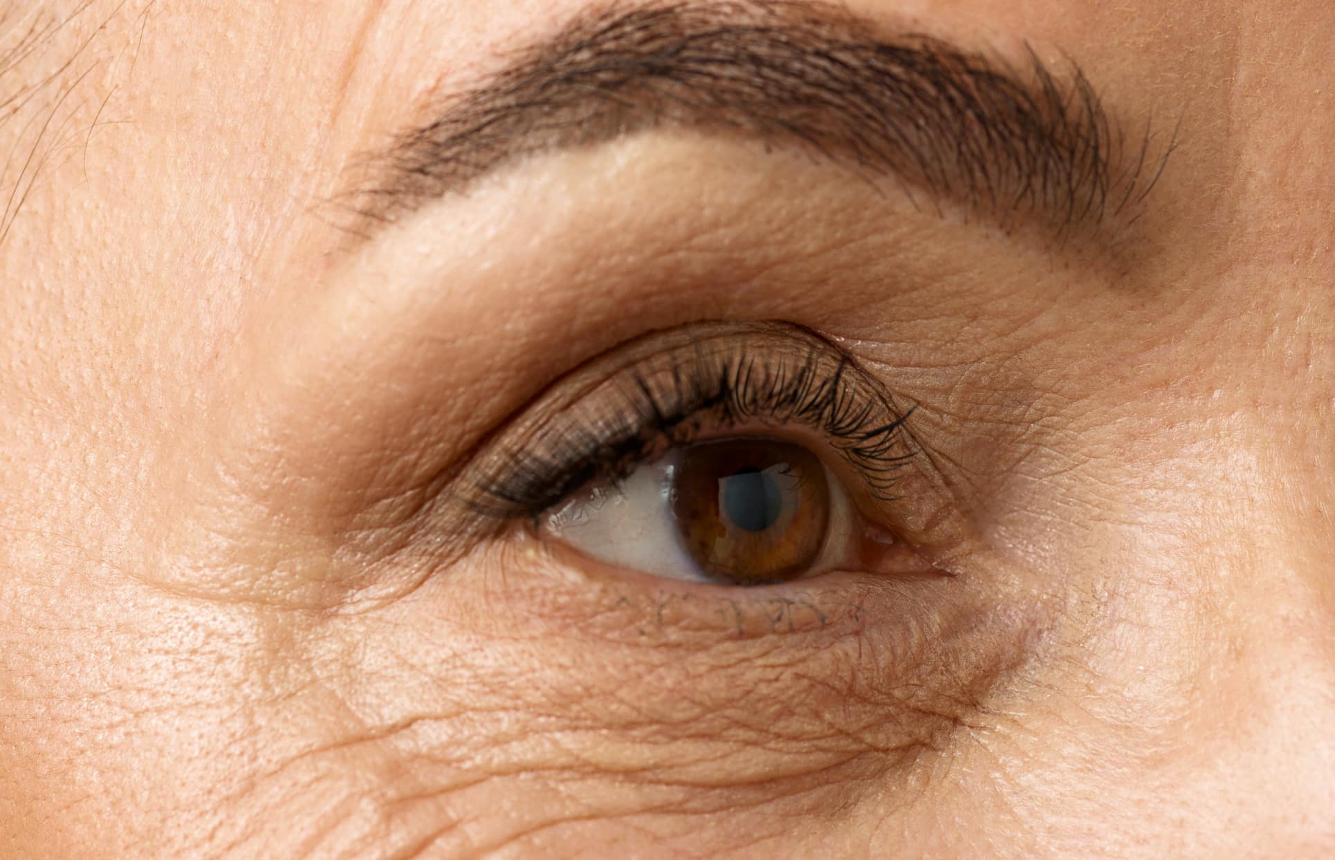 Photo rapprochee d un oeil d une femme blepharoplastie inferieure| Dr Christophe Reinbold Lyon